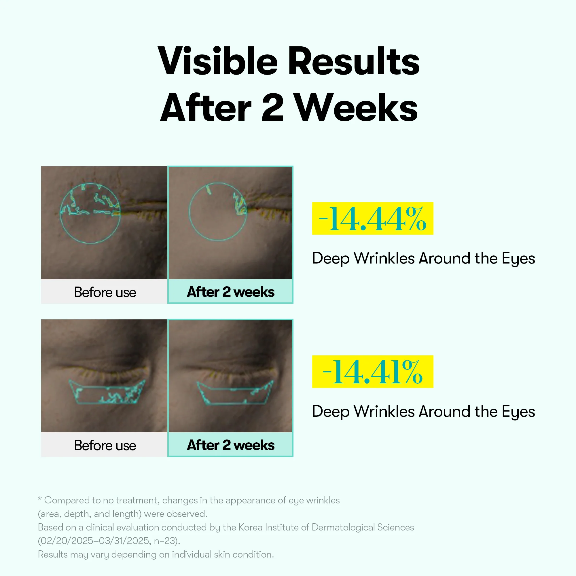 PDRN Reedle Shot Firming Eye Cream - Image 3